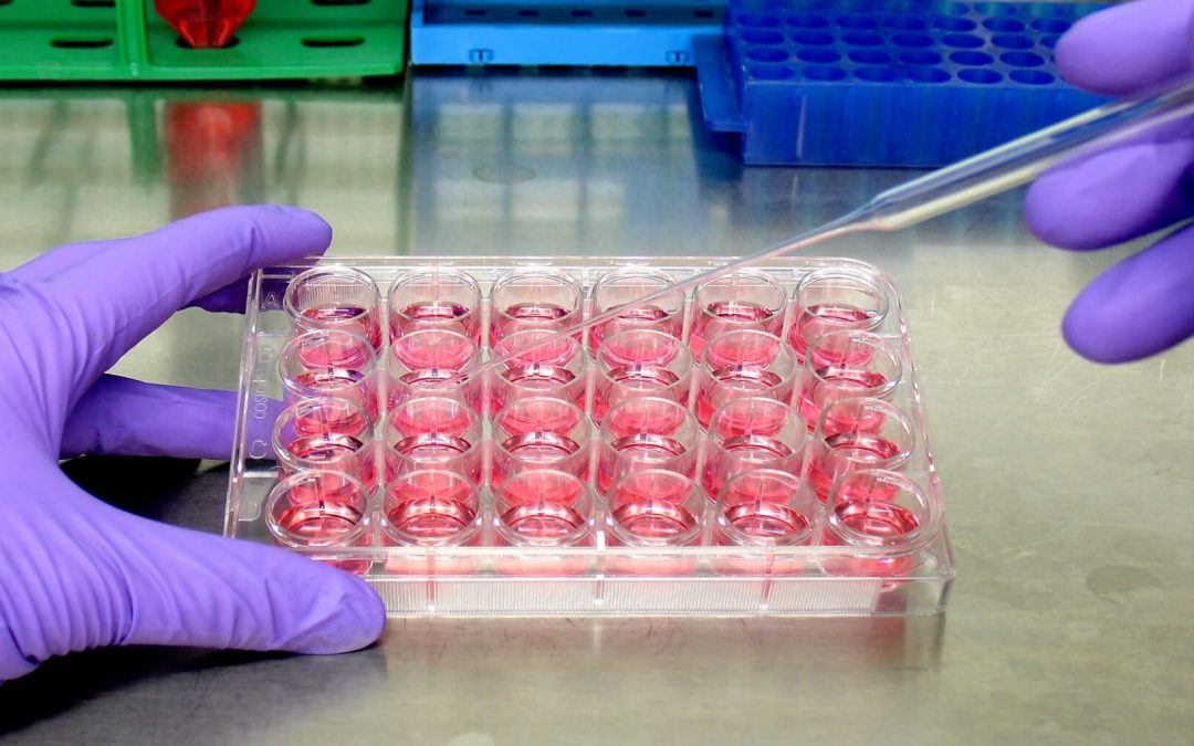Baltimore Clinical Trial for Neurosarcoidosis Patients